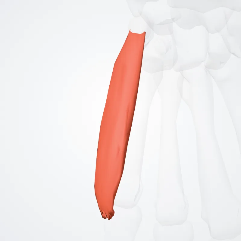 Abductor digiti minimi of hand (Abductor digiti minimi manus) highlighted in a 3D model of the human body