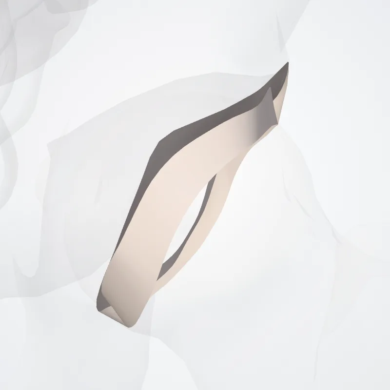 Labrum acetabuli (Acetabular labrum) hervorgehoben in einem 3D-Modell des menschlichen Körpers