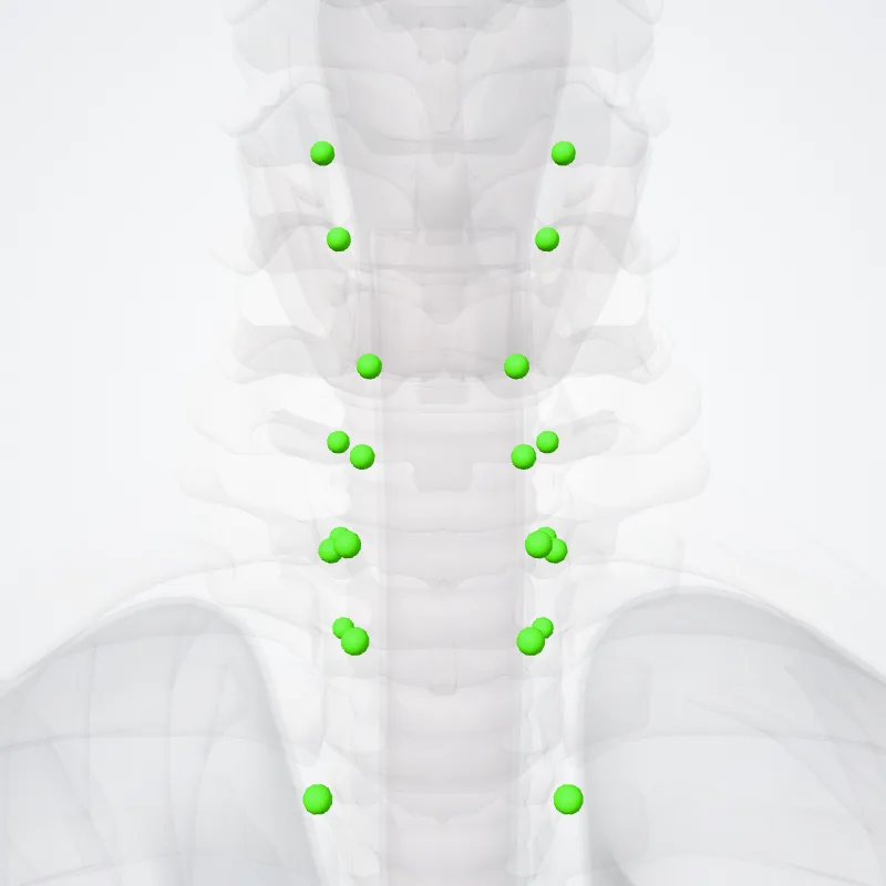 Nodi cervicales anteriores (Anterior cervical nodes) hervorgehoben in einem 3D-Modell des menschlichen Körpers