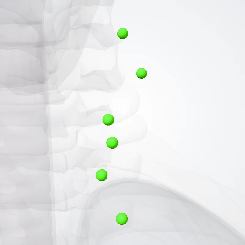 Nodi jugulares inferiores anteriores (Anterior inferior jugular nodes) hervorgehoben in einem 3D-Modell des menschlichen Körpers