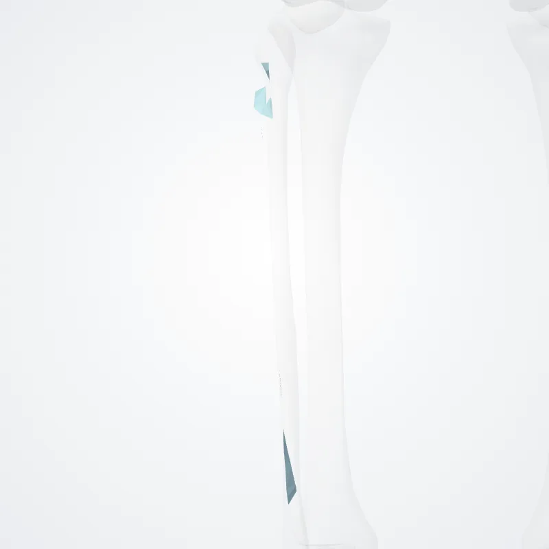 Anterior intermuscular septum of leg (Septum intermusculare anterius cruris) highlighted in a 3D model of the human body