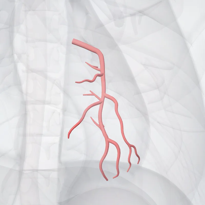 Anterior interventricular artery (Arteria interventricularis ant. arteriae coronariae sinistrae) highlighted in a 3D model of the human body