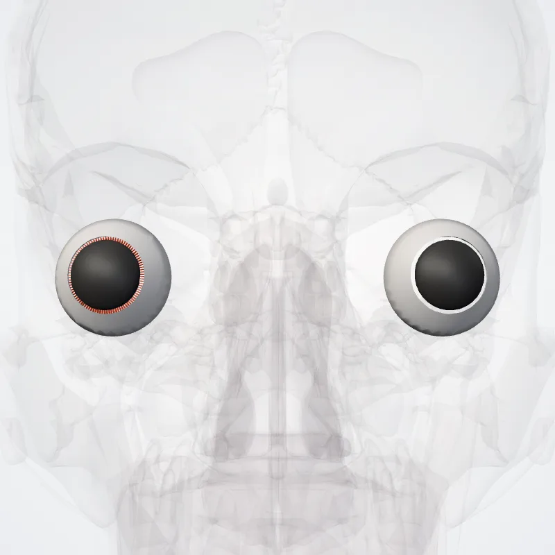 Segmentum anterius bulbi oculi (Anterior segment of eyeball) hervorgehoben in einem 3D-Modell des menschlichen Körpers