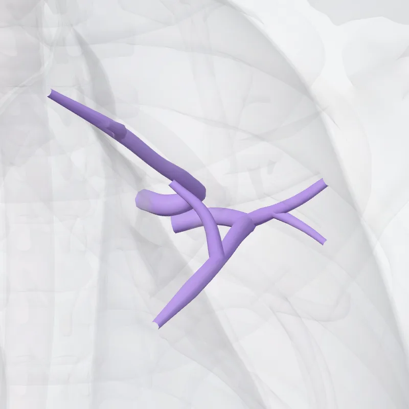 Anterior segmental artery of left lung (Arteria segmentalis anterior pulmonis sinistri) highlighted in a 3D model of the human body