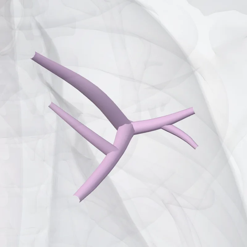 Bronchus segmentalis anterior pulmonis sinistri (BIII) (Anterior segmental bronchus of left lung (BIII)) hervorgehoben in einem 3D-Modell des menschlichen Körpers
