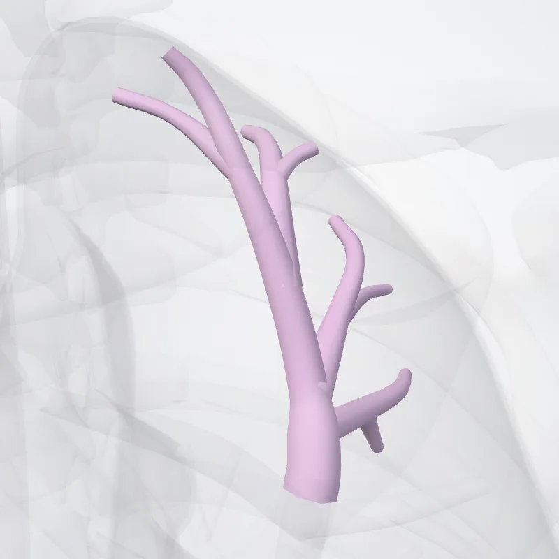 Bronchus segmentalis apicopost. pulmonis sinistri (BI+BII) (Apicoposterior segmental bronchus of left lung (BI+BII)) hervorgehoben in einem 3D-Modell des menschlichen Körpers