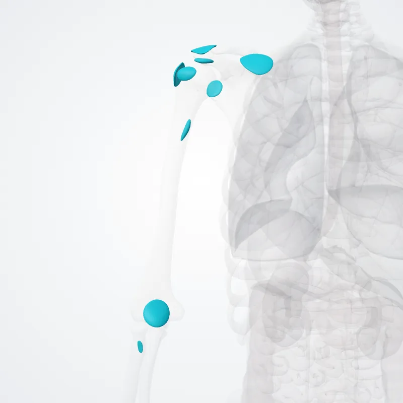 Bursae of upper limb (Bursae membri superiori) highlighted in a 3D model of the human body