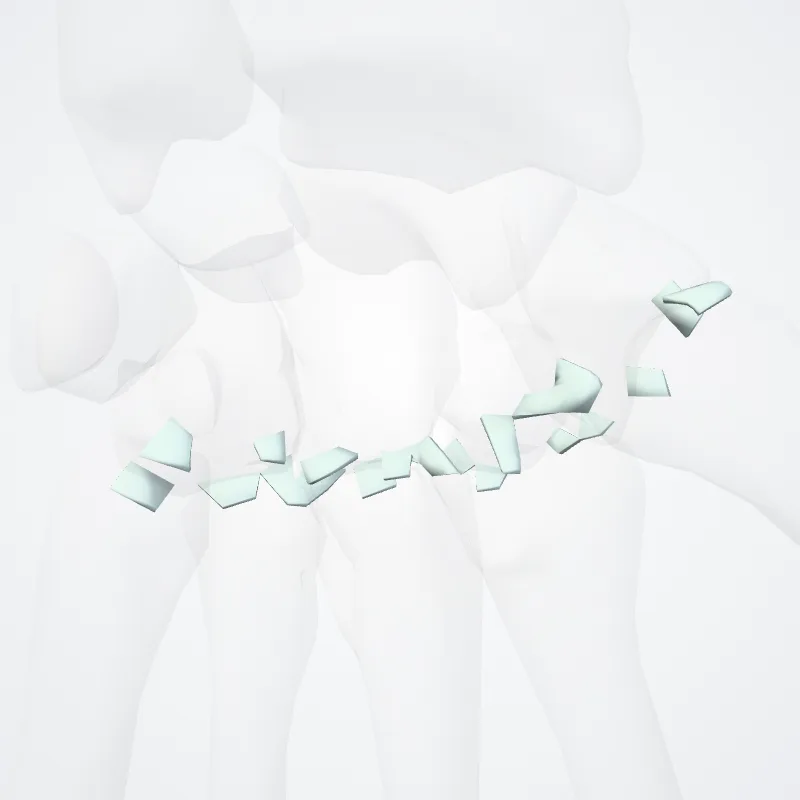 Articulationes carpometacarpeae (Carpometacarpal joints) hervorgehoben in einem 3D-Modell des menschlichen Körpers