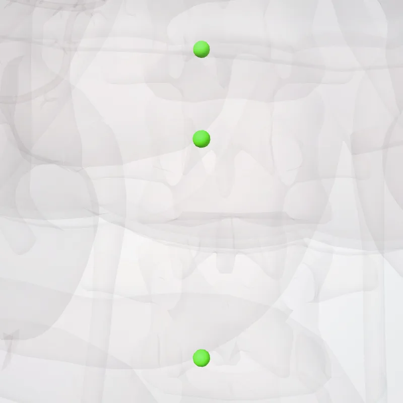Nodi mesenterici superiores centrales (Central superior mesenteric nodes) hervorgehoben in einem 3D-Modell des menschlichen Körpers