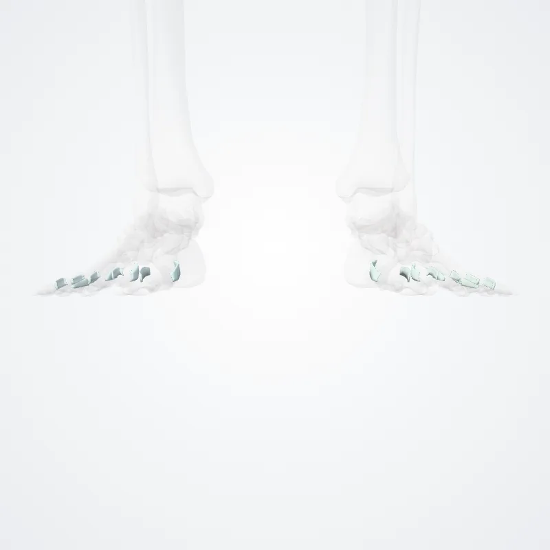 Ligamenta metatarsophalangea collateralia (Collateral metatarsophalangeal ligaments) hervorgehoben in einem 3D-Modell des menschlichen Körpers