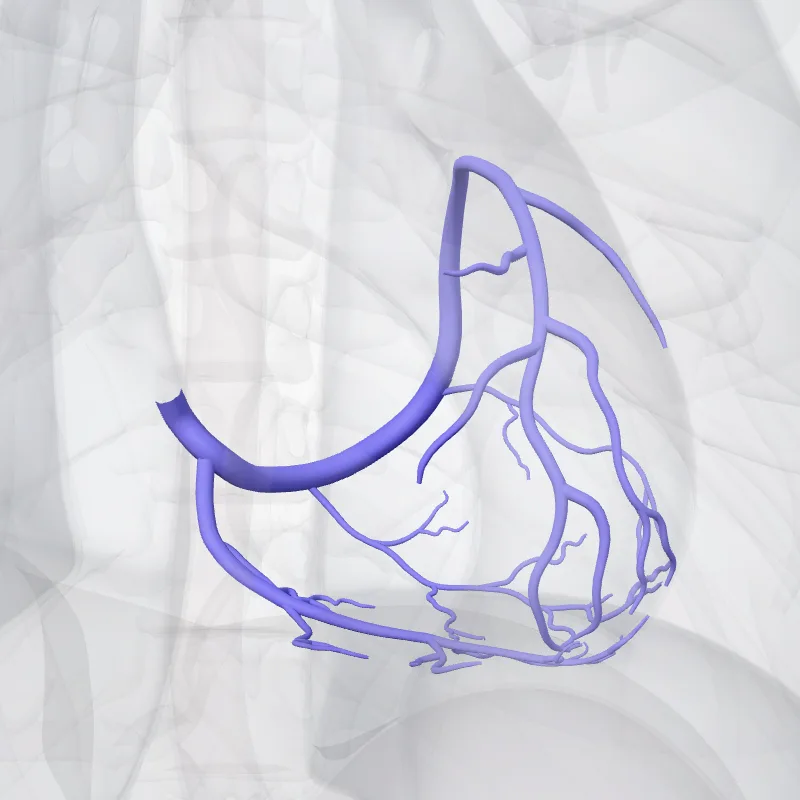 Sinus coronarius (Coronary sinus) hervorgehoben in einem 3D-Modell des menschlichen Körpers