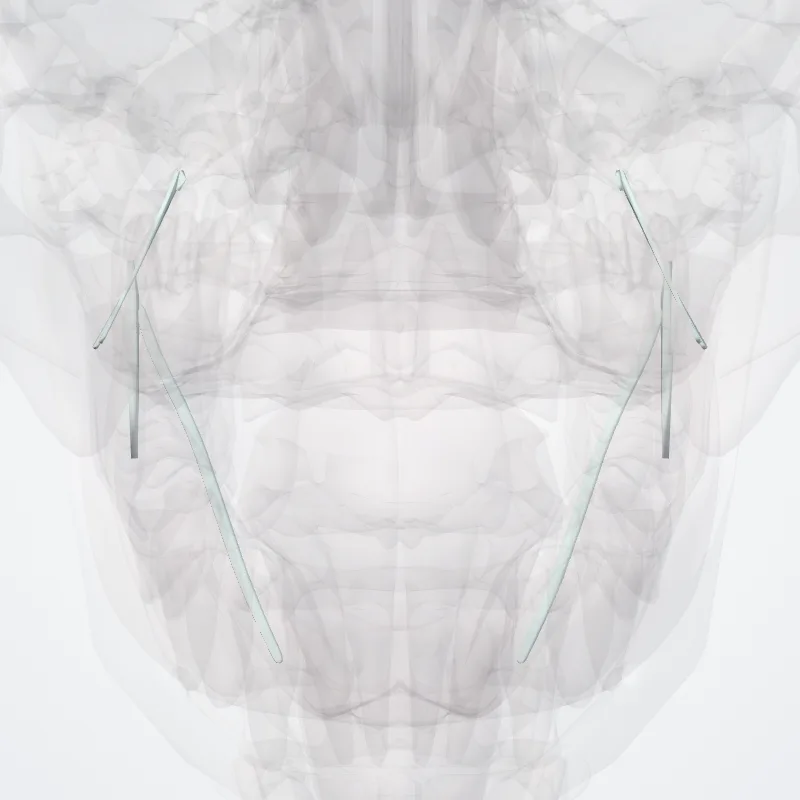 Syndesmoses cranii (Cranial syndesmoses) hervorgehoben in einem 3D-Modell des menschlichen Körpers