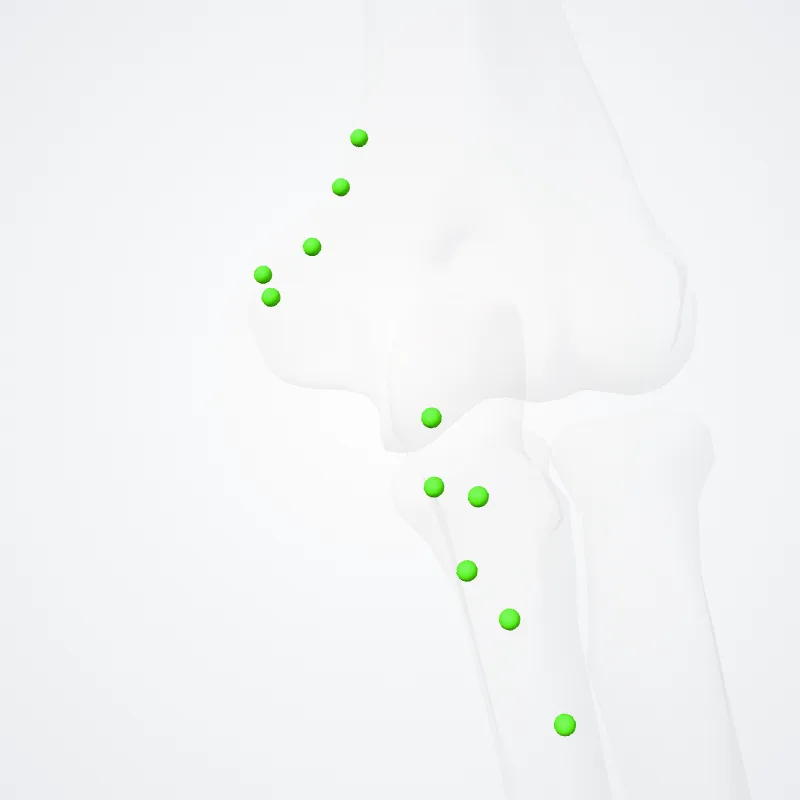 Cubital nodes (Nodi cubitales) highlighted in a 3D model of the human body