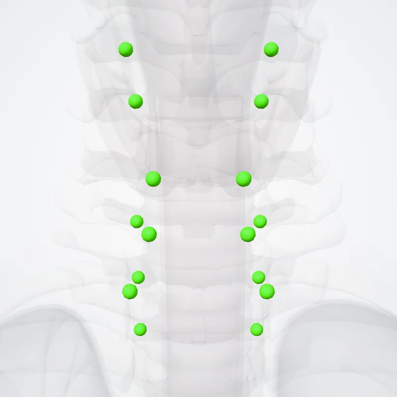 Deep anterior cervical nodes (Nodi cervicales anteriores profundi) highlighted in a 3D model of the human body