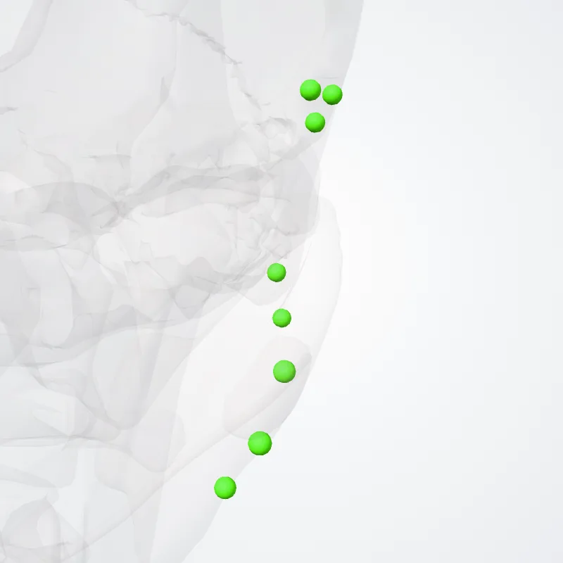Nodi parotidei profundi (Deep parotid nodes) hervorgehoben in einem 3D-Modell des menschlichen Körpers