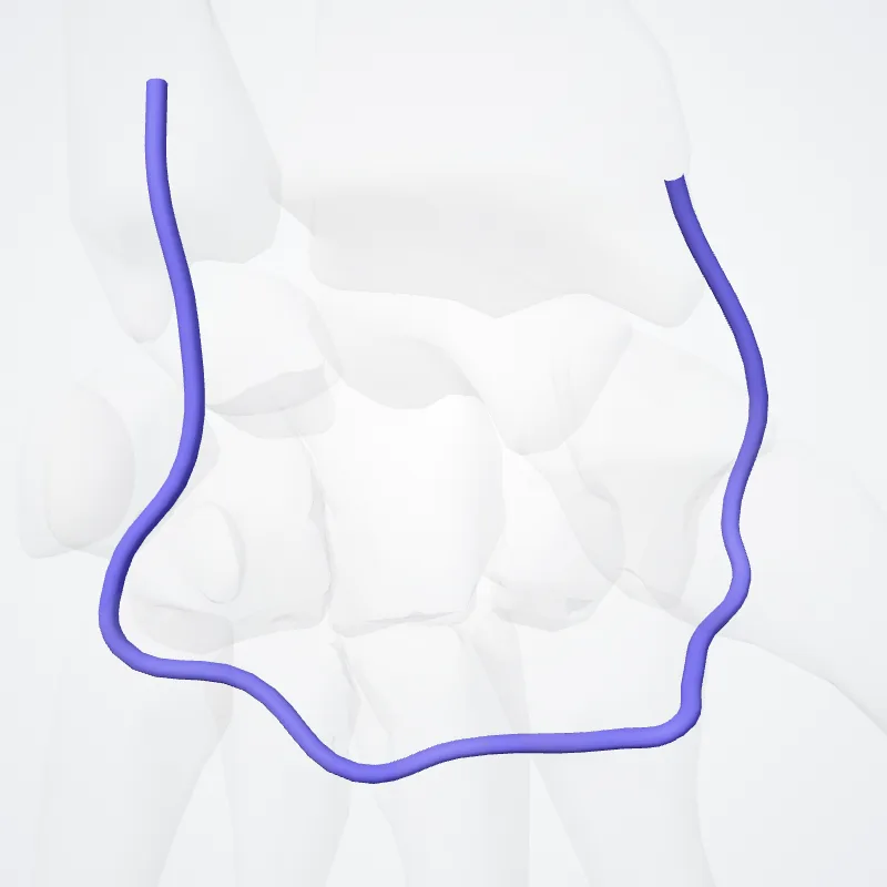 Deep venous palmar arch (Arcus venosus palmaris profundus) highlighted in a 3D model of the human body