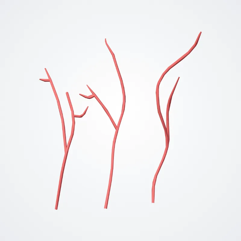 Distal lateral striate branches highlighted in a 3D model of the human body