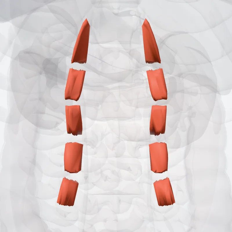 Partes dors. musculorum intertransversariorum lat. lumborum (Dorsal parts of lateral intertransversarii lumborum muscles) hervorgehoben in einem 3D-Modell des menschlichen Körpers
