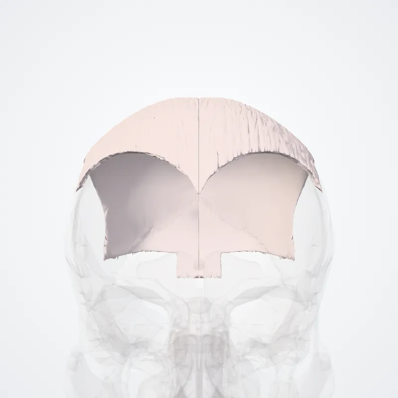 Epicranial aponeurosis (Galea aponeurotica) highlighted in a 3D model of the human body