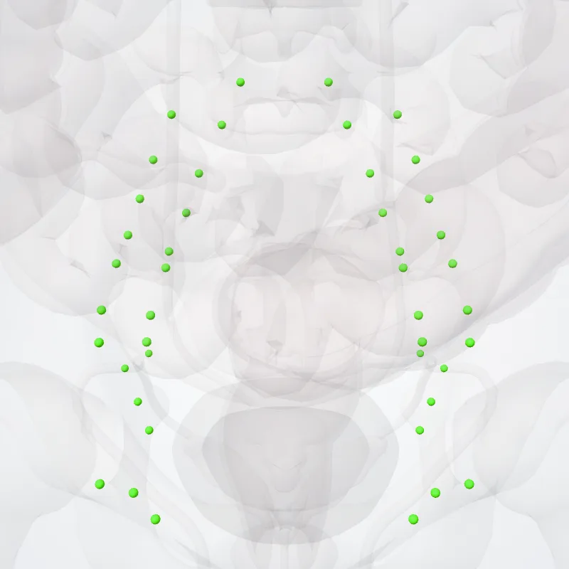 Nodi iliaci externi (External iliac nodes) hervorgehoben in einem 3D-Modell des menschlichen Körpers