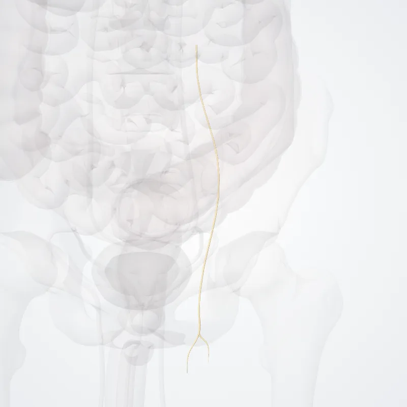 Femoral branch of genitofemoral nerve (Ramus femoralis nervi genitofemoralis) highlighted in a 3D model of the human body