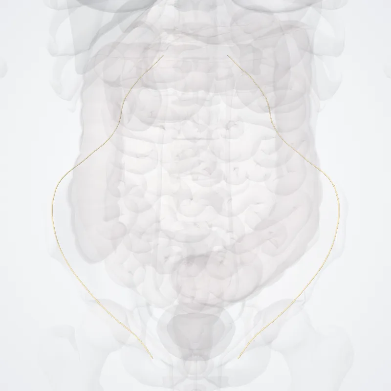 Ilio-inguinal nerve (Nervus ilioinguinalis) highlighted in a 3D model of the human body