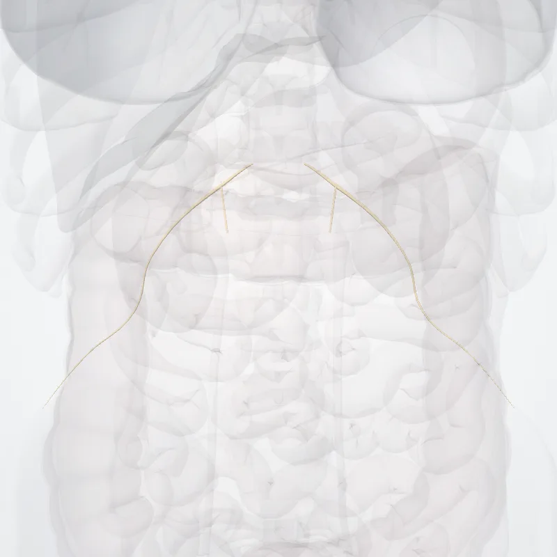 Iliohypogastric nerve (Nervus iliohypogastricus) highlighted in a 3D model of the human body