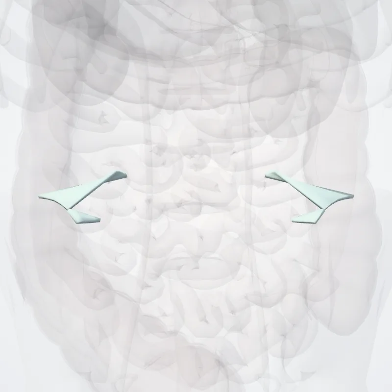 Ligamentum iliolumbale (Iliolumbar ligament) hervorgehoben in einem 3D-Modell des menschlichen Körpers