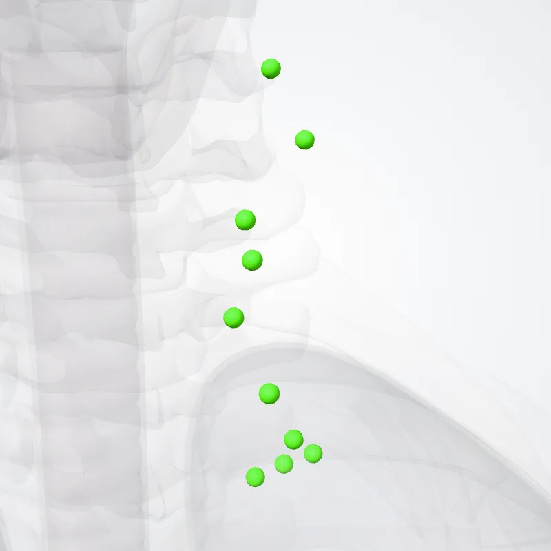 Nodi cervicales latérales profundi inferiores (Inferior deep lateral cervical nodes) hervorgehoben in einem 3D-Modell des menschlichen Körpers