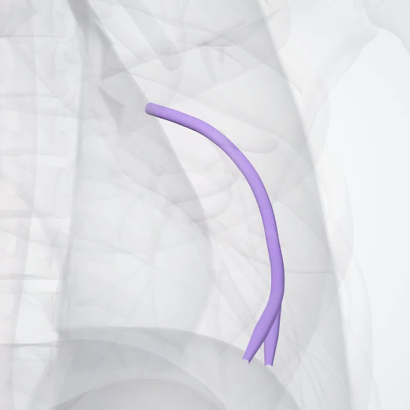 Arteria lingularis inferior pulmonis sinistri (Inferior lingular artery of left lung) hervorgehoben in einem 3D-Modell des menschlichen Körpers