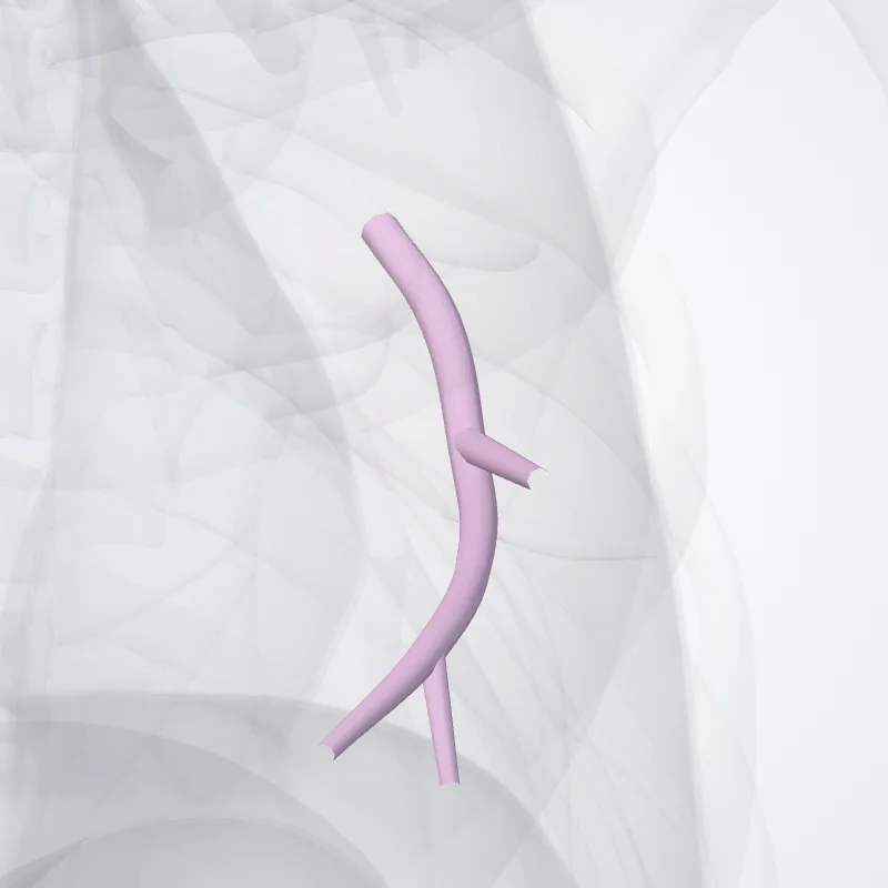 Inferior lingular segmental bronchus of left lung (BV) (Bronchus segmentalis lingularis inf. pulmonis sinistri (BV)) highlighted in a 3D model of the human body