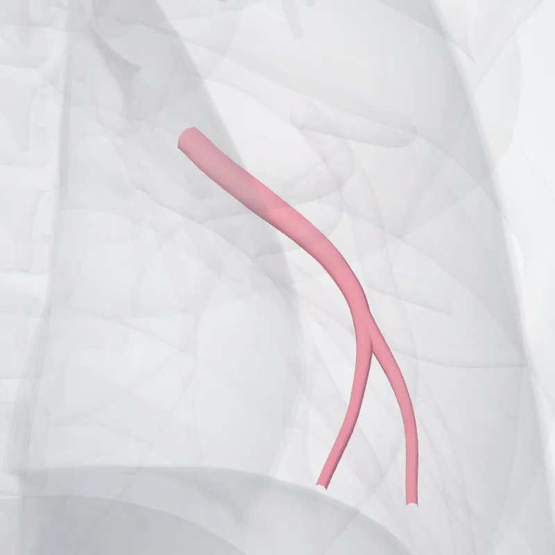 Vena lingularis inferior pulmonis sinistri (Inferior lingular vein of left lung) hervorgehoben in einem 3D-Modell des menschlichen Körpers