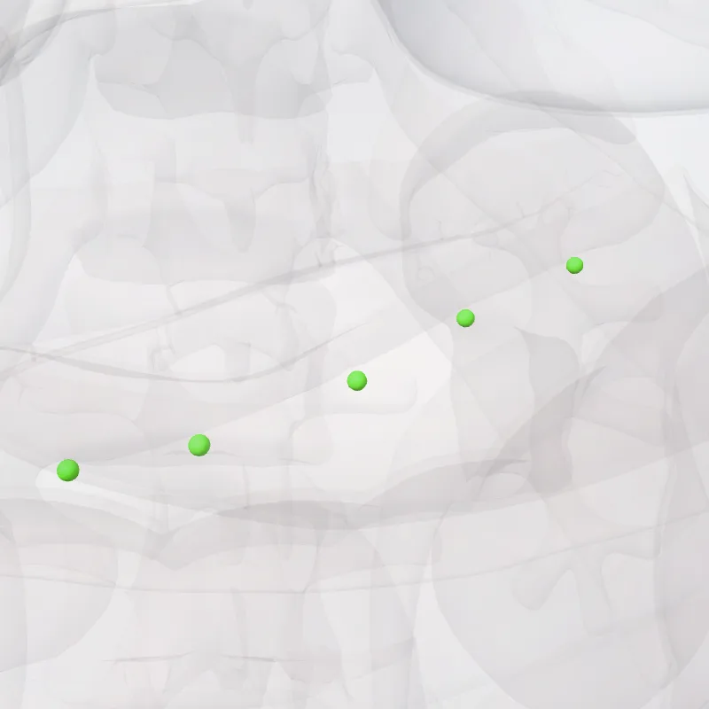 Inferior pancreatic nodes (Nodi pancreatici inferiores) highlighted in a 3D model of the human body