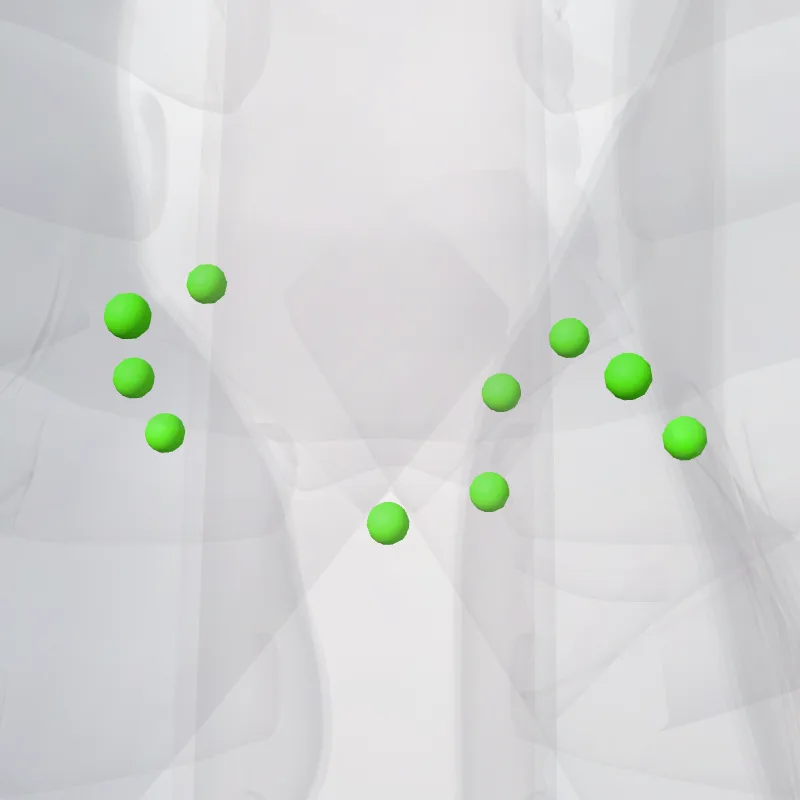 Nodi tracheobronchiales inferiores (Inferior tracheobronchial nodes) hervorgehoben in einem 3D-Modell des menschlichen Körpers