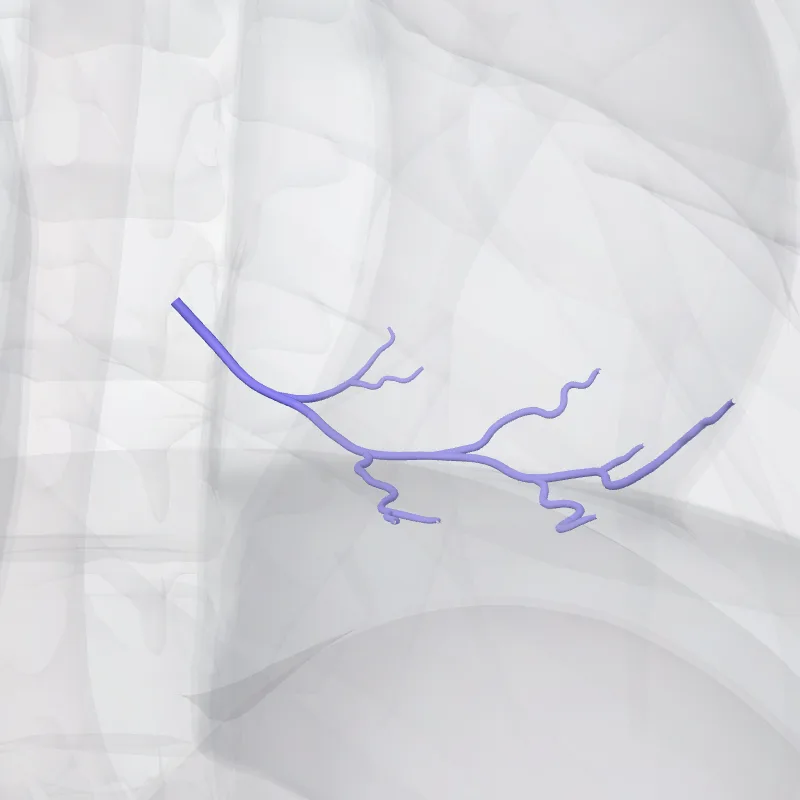 Inferior vein of left ventricle (//Posterior '') highlighted in a 3D model of the human body