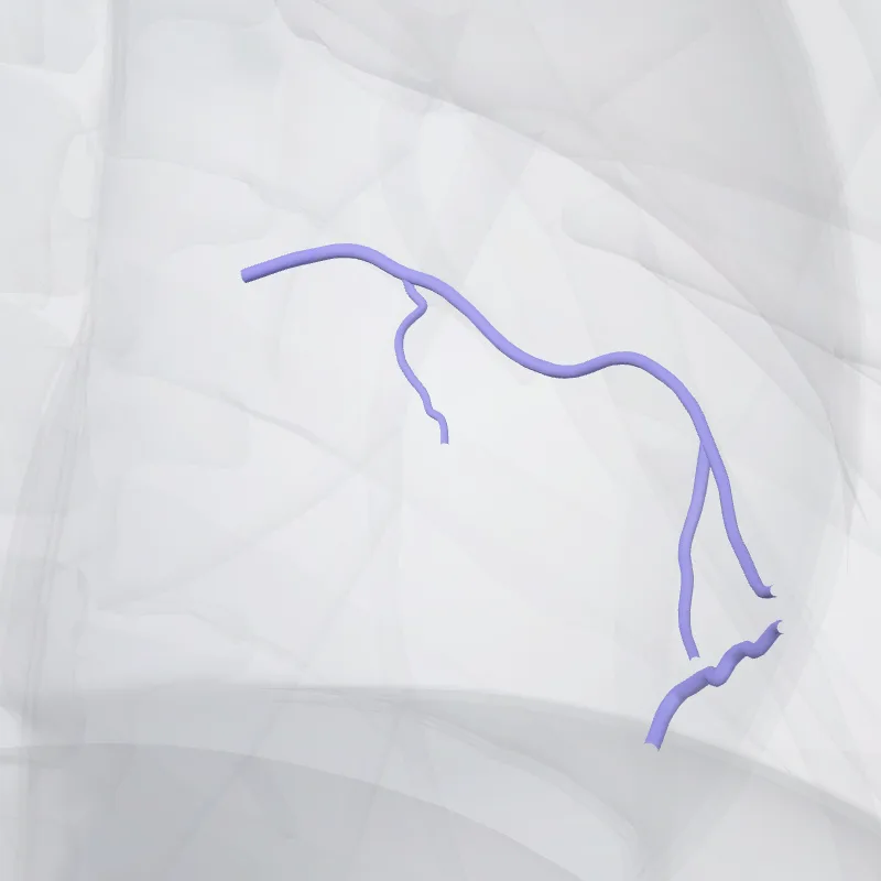Inferior vein of left ventricle (Vena inferior ventriculi sinistri) highlighted in a 3D model of the human body