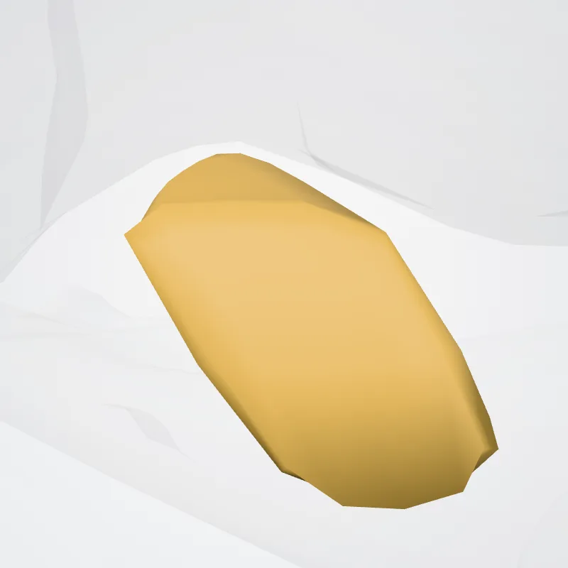 Corpus adiposum infrapatellare (Infrapatellar fat pad) hervorgehoben in einem 3D-Modell des menschlichen Körpers