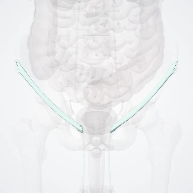 Inguinal ligament (Ligamentum inguinale) highlighted in a 3D model of the human body