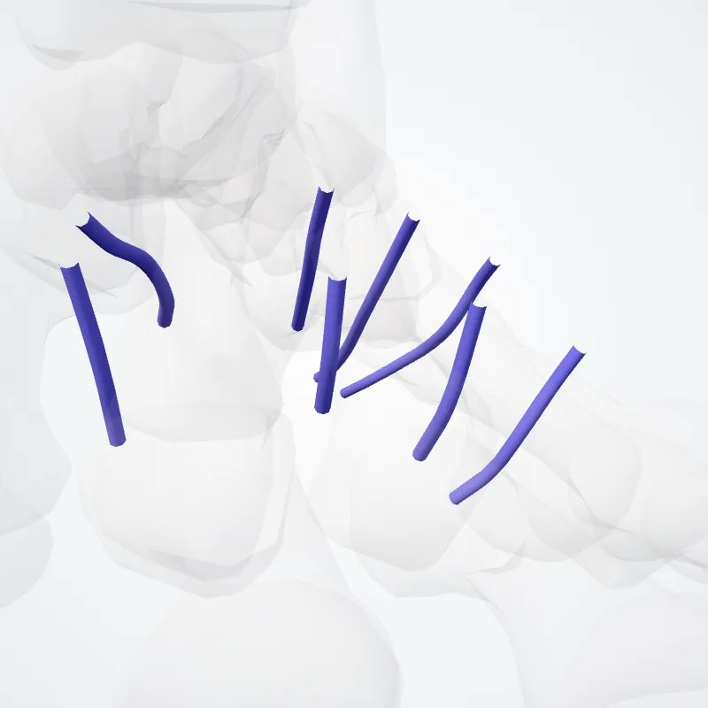 Venae intercapitulares pedis (Intercapitular veins of foot) hervorgehoben in einem 3D-Modell des menschlichen Körpers