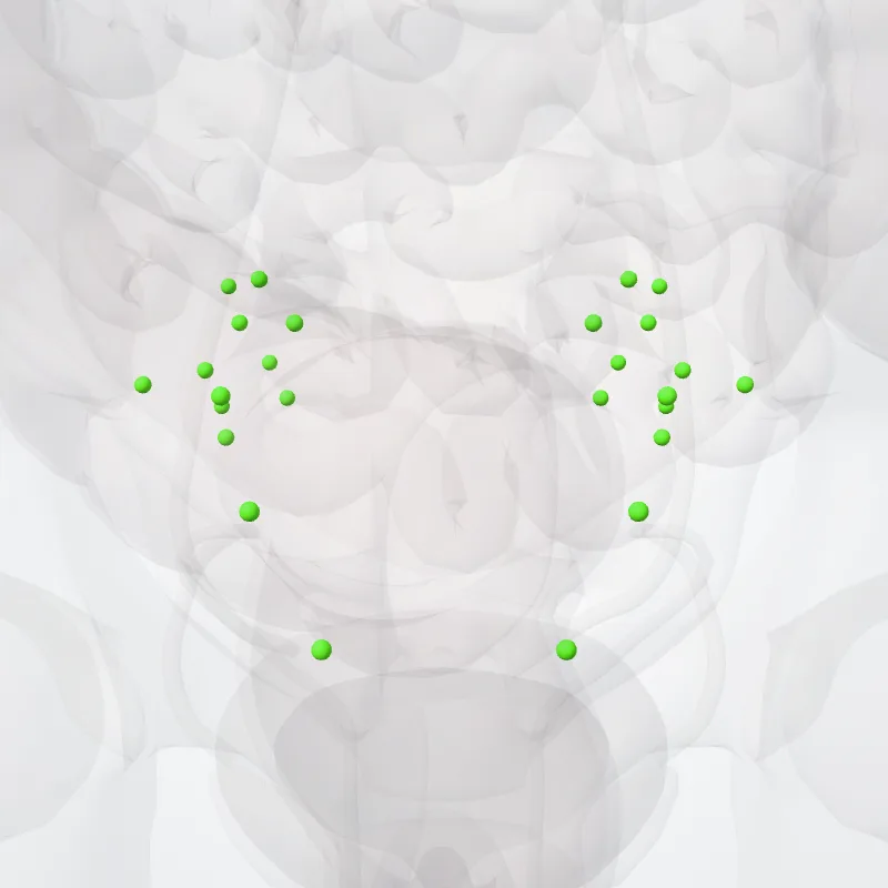 Internal iliac nodes (Nodi iliaci interni) highlighted in a 3D model of the human body
