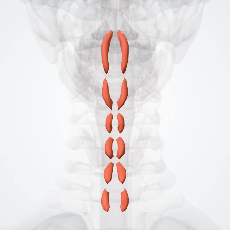 Interspinales colli muscles (Musculi interspinales colli) highlighted in a 3D model of the human body
