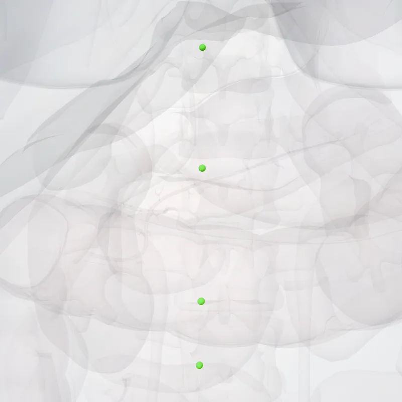 Lateral aortic nodes (Nodi aortici latérales) highlighted in a 3D model of the human body