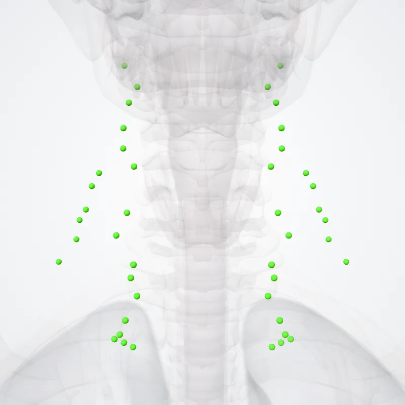 Lateral cervical nodes (Nodi cervicales latérales) highlighted in a 3D model of the human body