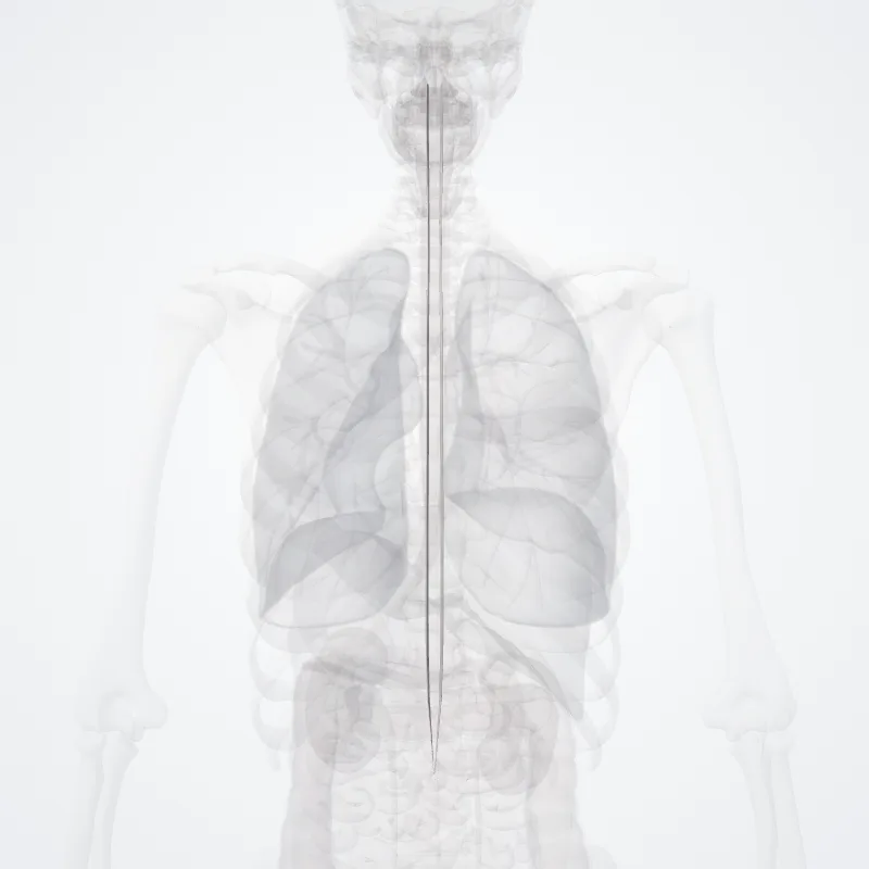 Lateral spinothalamic tract (Tractus spinothalamicus lateralis) highlighted in a 3D model of the human body