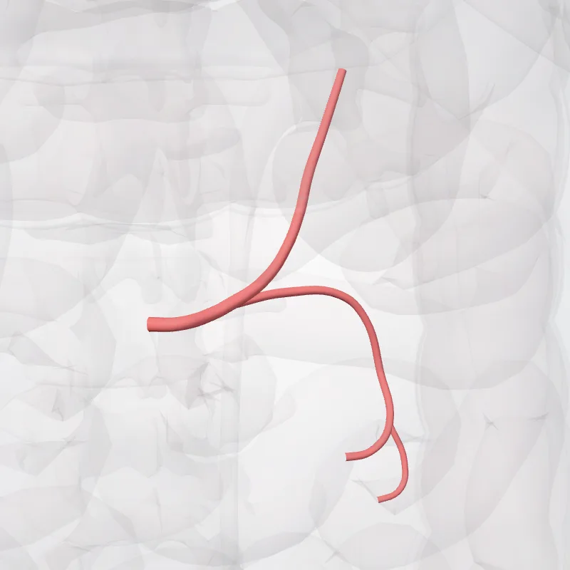 Left colic artery (Arteria colica sinistra) highlighted in a 3D model of the human body