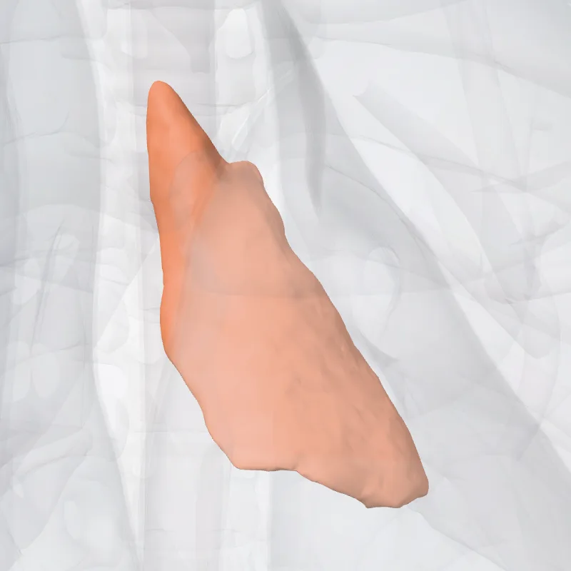 Left lobe of thymus (Lobus thymi sinistri) highlighted in a 3D model of the human body