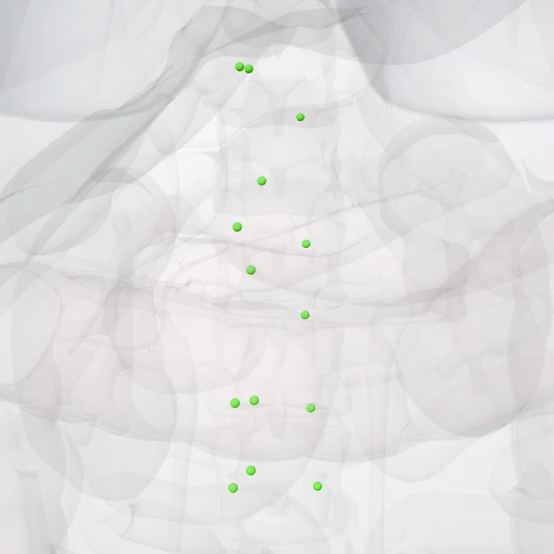 Left lumbar nodes (Nodi lumbales sinistri) highlighted in a 3D model of the human body