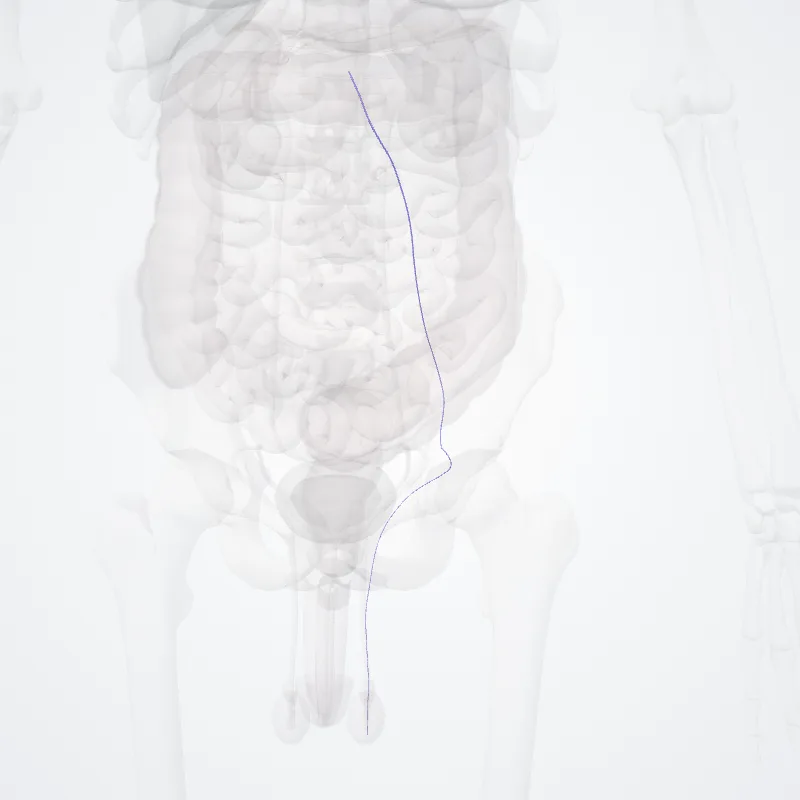 Vena testicularis sinistra (Left testicular vein) hervorgehoben in einem 3D-Modell des menschlichen Körpers