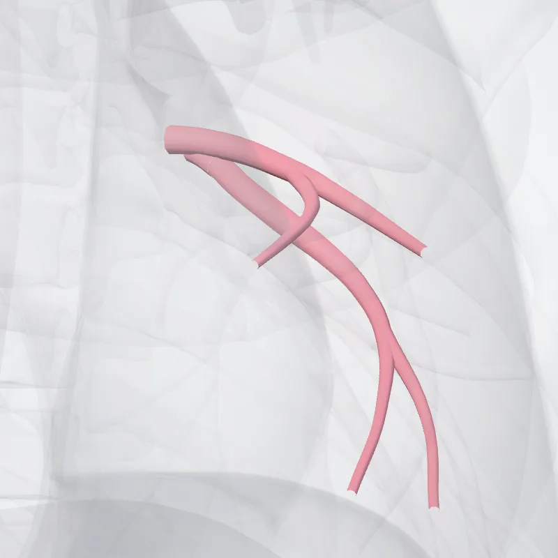 Lingular vein of left lung (Vena lingularis pulmonis sinistri) highlighted in a 3D model of the human body