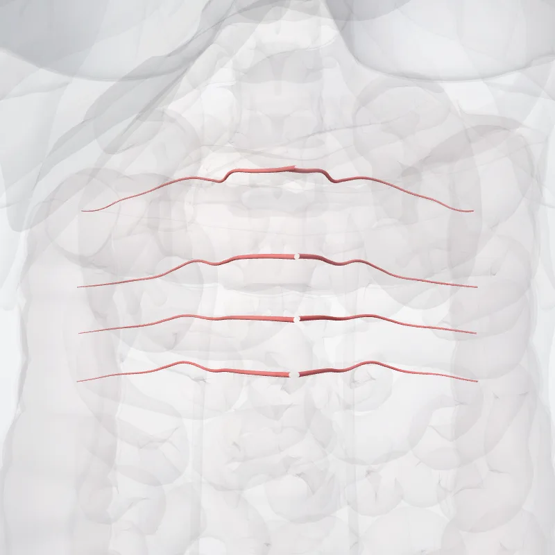 Arteriae lumbales (Lumbar arteries) hervorgehoben in einem 3D-Modell des menschlichen Körpers